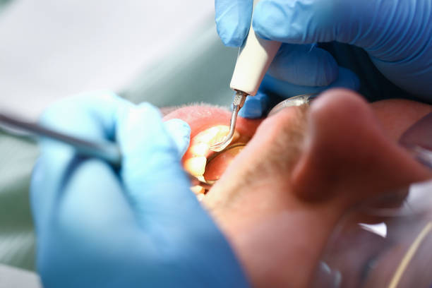 Best Emergency Treatment for Oral Infections in Cedar Park, TX